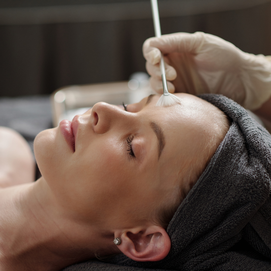 Facial con peeling químico