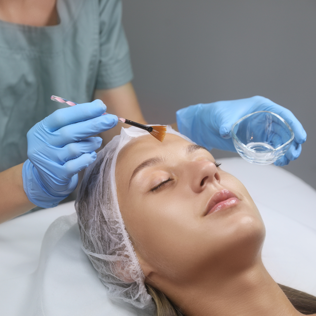 Facial con peeling químico
