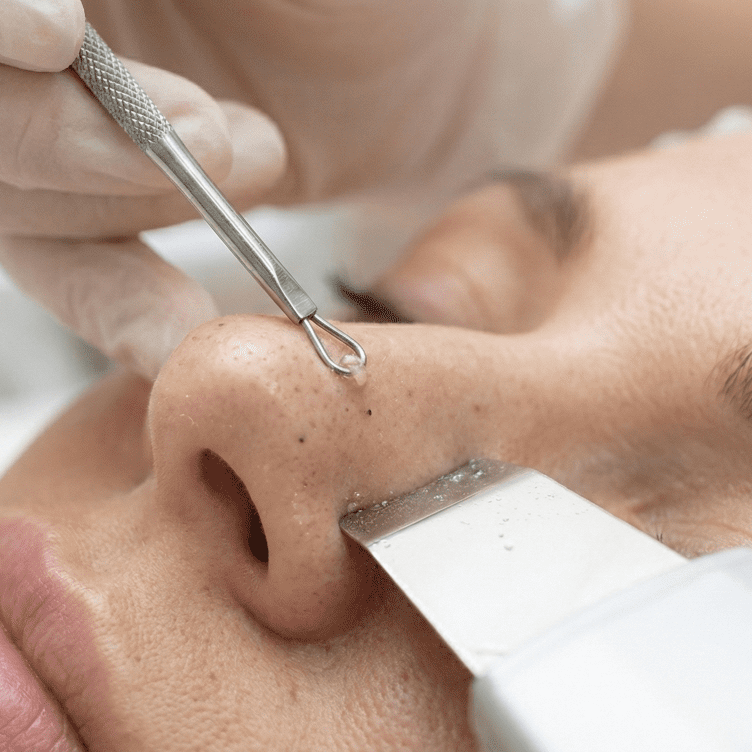 Limpieza Facial Profunda