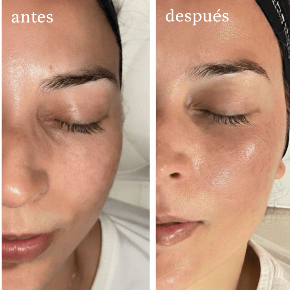 Facial Hidratante